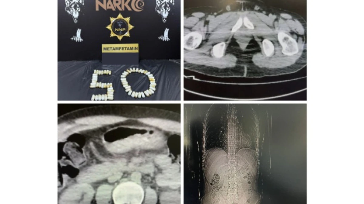 EMNİYET UYUŞTURUCU OPERASYONU 